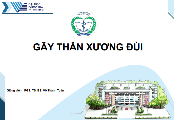 Slide Bài Giảng Gãy Thân Xương đùi