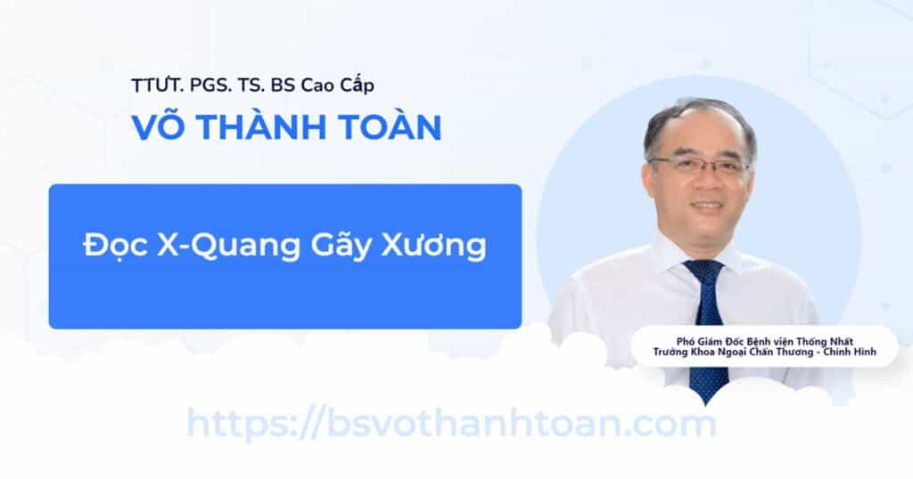 Trật xương bánh chè