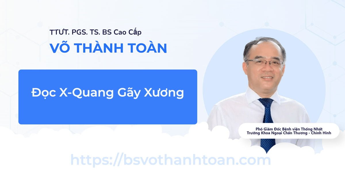 Trật xương bánh chè