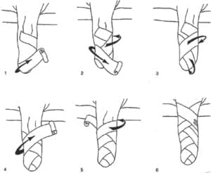 Kỹ Thuật Băng Mỏm Dưới [3]