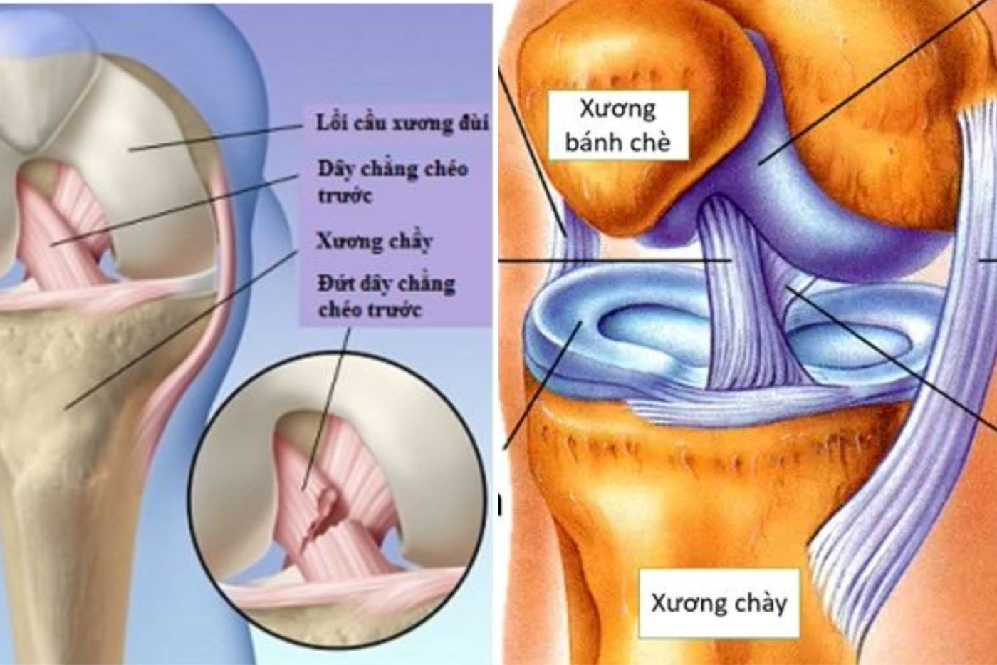 Dây Chằng Khớp Gối