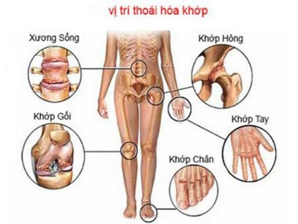 Khớp Là Gì 3