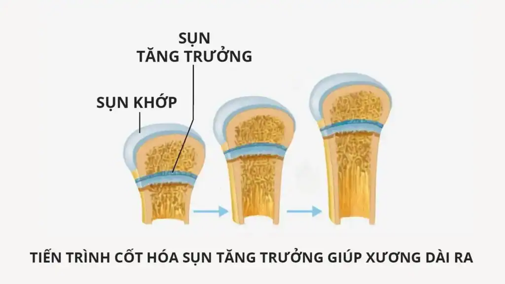 Hình ảnh mô phỏng quá trình sụn xương tăng trưởng theo chiều dài xương.