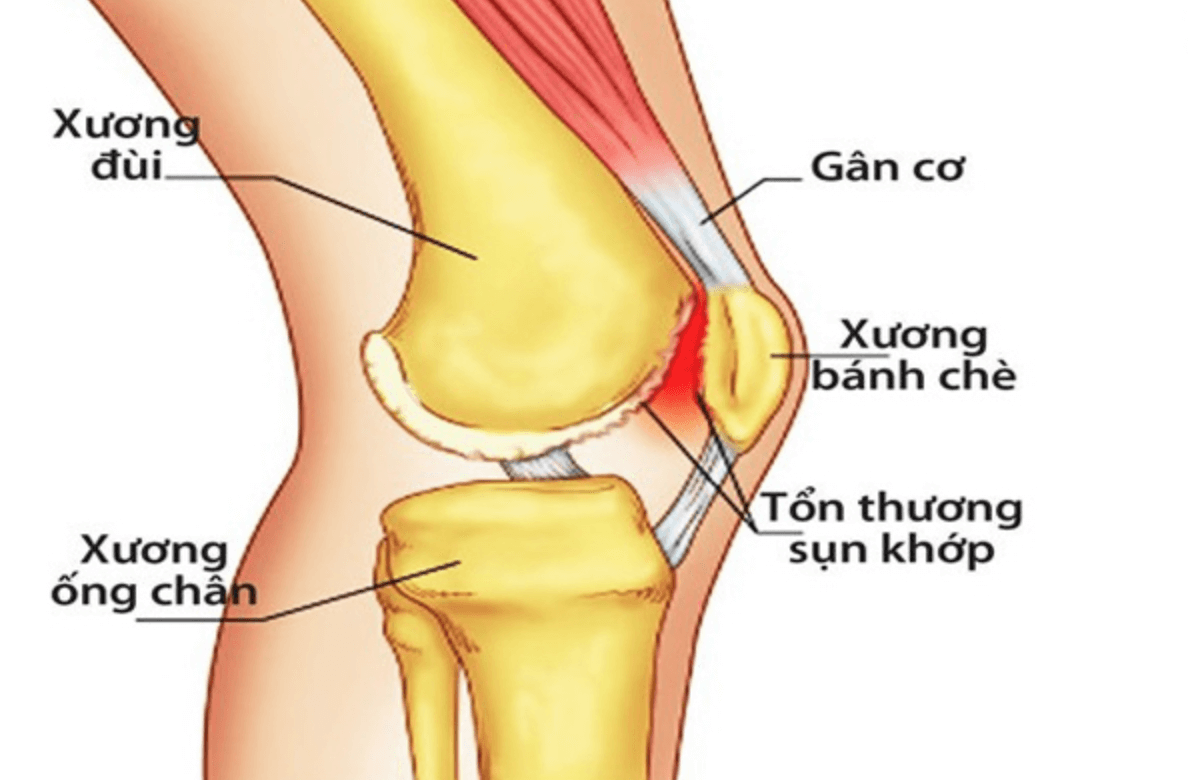 Khớp Gối 1