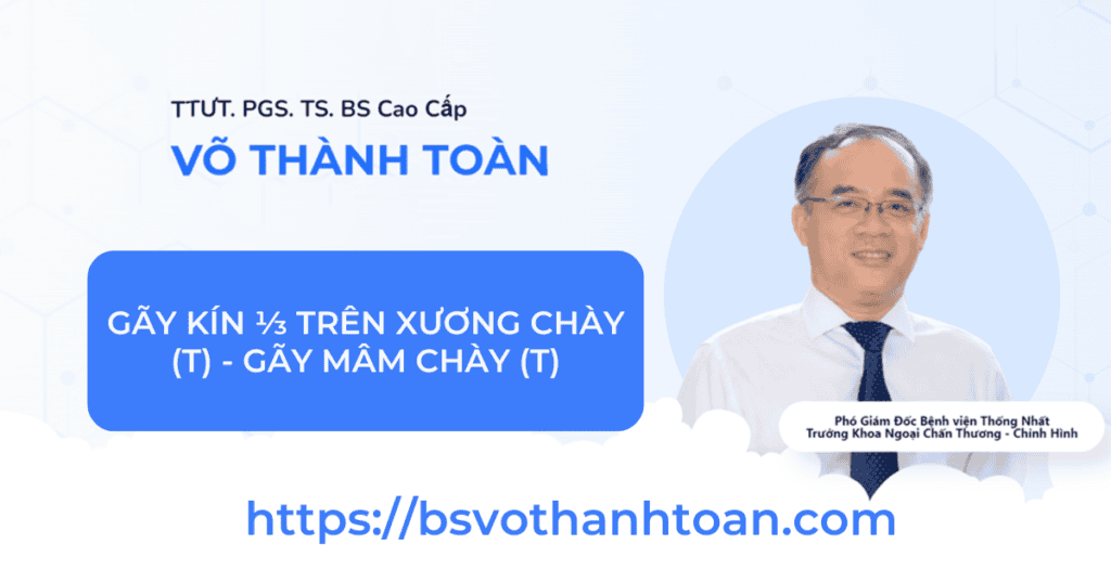 Hình ảnh bác sĩ Võ Thành Toàn tư vấn về gãy kín trên xương chày và mâm chày, chuyên gia hàng đầu về chấn thương xương khớp.